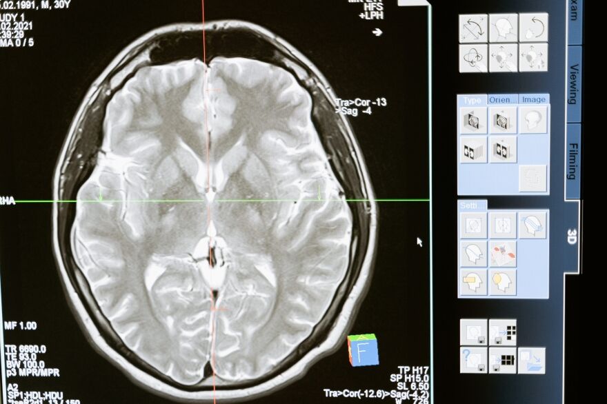 Diagnosing Internal Injuries