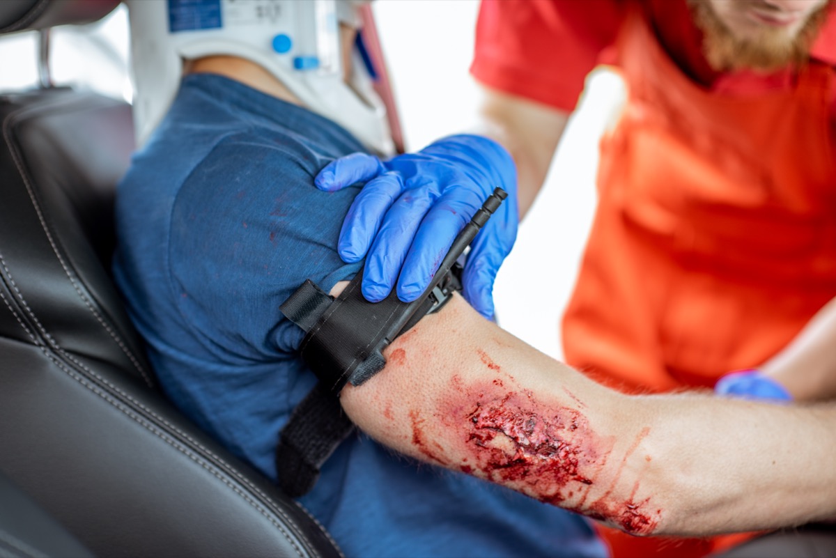 Minor Injuries Can Have Major Impacts In Personal Injury Cases