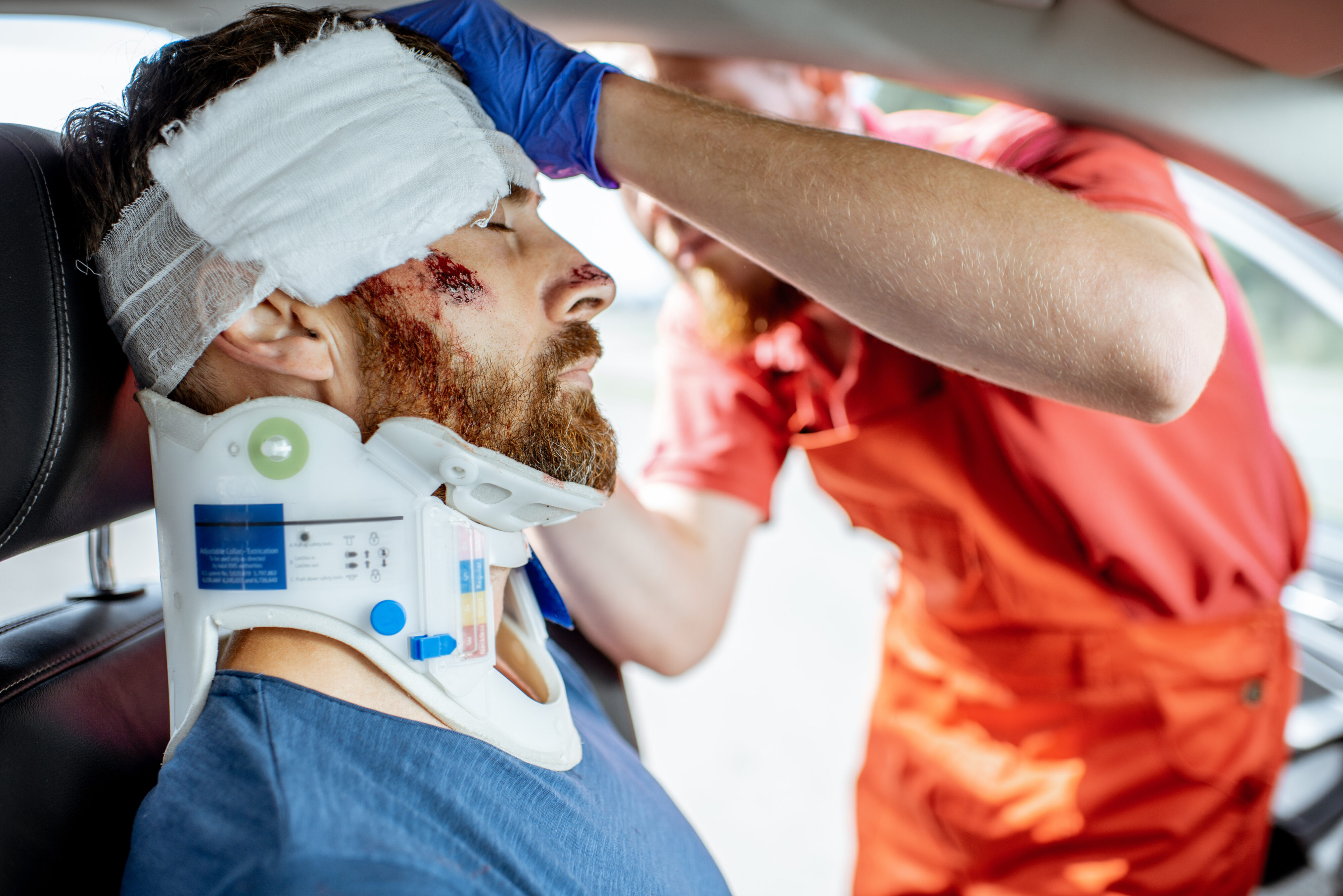 The Impact of Mild vs. Severe Head Injuries in Accident Cases