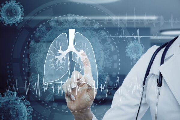 Doctor pointing to set of lungs with mesothelioma - Saladino & Schaaf, lawyers for mesothelioma.
