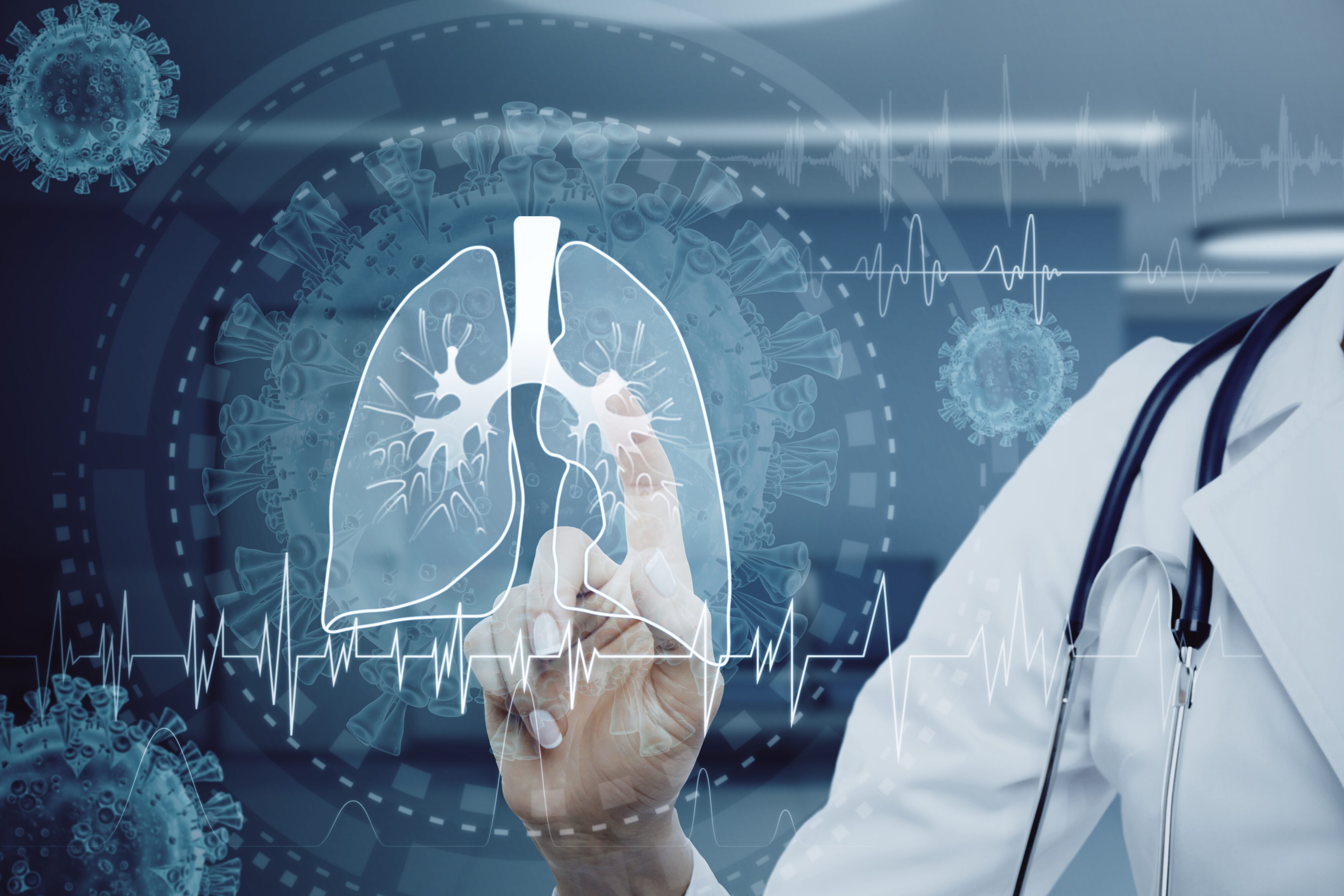 Mesothelioma: What Is It and What Are Your Legal Options?
